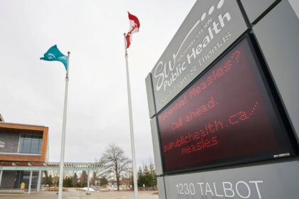 canada premature baby with measles dies amid outbreak in ontario 684294d642405