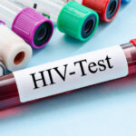 cercetatorii australieni uluiti de efectele unui nou tratament contra hiv descoperirea care ar putea duce la eradicarea virusului 68450b66ec348