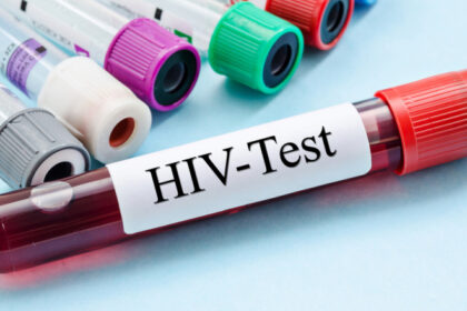 cercetatorii australieni uluiti de efectele unui nou tratament contra hiv descoperirea care ar putea duce la eradicarea virusului 68450b66ec348