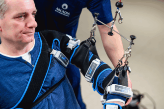 desi alte spitale nu ii dadeau sanse un profesor s a recuperat dupa un avc la spitalul de recuperare medicala arcadia din iasi 6852024c5f036