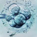 ceasul biologic al barbatilor legat de avorturile spontane in cazul fertilizarii in vitro 686c0ff0c0686