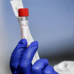 studiu revolutionar la stanford un test de sange poate estima varsta biologica a organelor umane 6873644396568