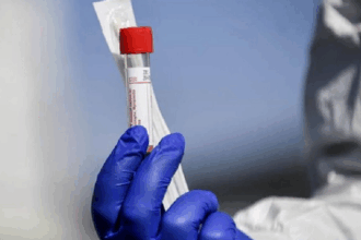 studiu revolutionar la stanford un test de sange poate estima varsta biologica a organelor umane 6873644396568