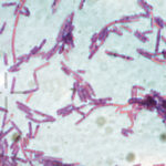 suspiciune de antrax la doua persoane internate la institutul national de boli infectioase matei bals din bucuresti 686e8fc1dbcff