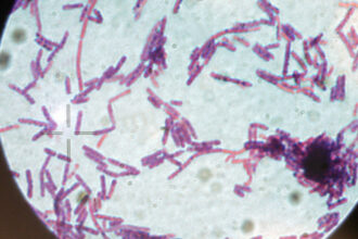 suspiciune de antrax la doua persoane internate la institutul national de boli infectioase matei bals din bucuresti 686e8fc1dbcff