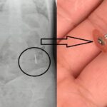 un dentist din iasi a scapat in gura unui copil de 5 ani un dispozitiv metalic iar acesta a inghitit o ce va agitati n a murit plangea mai tare pentru ca tipa mama 686dbb5fdc8dc