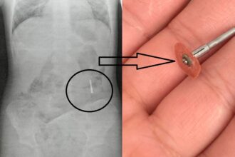 un dentist din iasi a scapat in gura unui copil de 5 ani un dispozitiv metalic iar acesta a inghitit o ce va agitati n a murit plangea mai tare pentru ca tipa mama 686dbb5fdc8dc