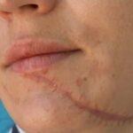 un individ din iasi a fost arestat dupa ce si a batut ingrozitor sotia si a taiat o pe fata a fost foarte gelos 6867f66973e30