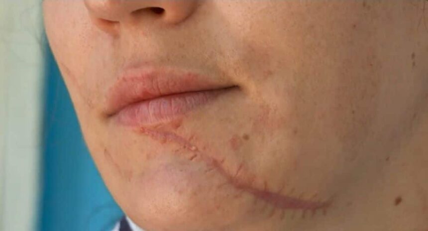 un individ din iasi a fost arestat dupa ce si a batut ingrozitor sotia si a taiat o pe fata a fost foarte gelos 6867f66973e30