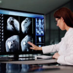 un proiect urias de imagistica medicala va schimba felul in care bolile sunt depistate ce arata imaginile despre consumul de alcool 687f10c8e1e4d