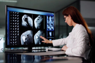 un proiect urias de imagistica medicala va schimba felul in care bolile sunt depistate ce arata imaginile despre consumul de alcool 687f10c8e1e4d