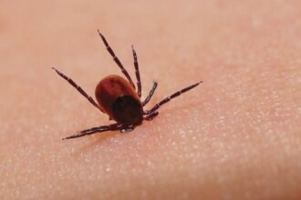 boala lyme mult supradiagnosticata la noi si in restul lumii evolueaza in trei etape in lipsa profilaxiei sau tratamentului corect prof univ dr simin aysel florescu 68a1929e60a3e