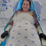 care este starea laviniei pacienta cu arsuri infectata la floreasca si transferata in belgia anuntul surorii sale ramane un mister 689f6fd09fa48