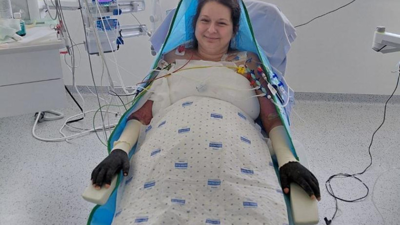 care este starea laviniei pacienta cu arsuri infectata la floreasca si transferata in belgia anuntul surorii sale ramane un mister 689f6fd09fa48