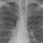 ce este si cum se transmite boala legionarilor epidemie cinci morti si peste 100 de cazuri confirmate 68a59bb740e6f