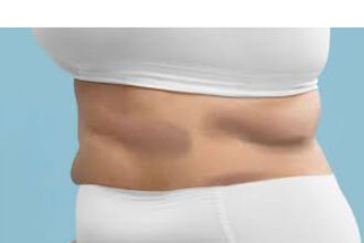 criolipoliza revolutioneaza remodelarea corporala tratament de top pentru rezultate vizibile fara bisturiu 6899dba9075f0