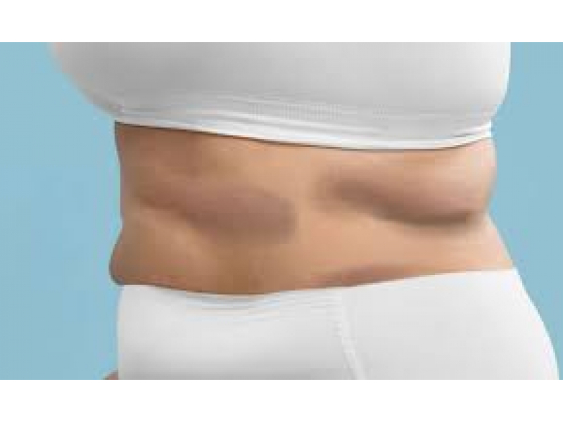 criolipoliza revolutioneaza remodelarea corporala tratament de top pentru rezultate vizibile fara bisturiu 6899dba9075f0