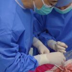 in premiera transplant de plaman de porc la om in china organul a functionat timp de noua zile 68aeaf5e9bd5a