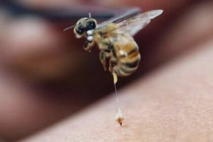 intepatura de albine sau viespi cum eviti socul anafilactic dr stan persoanele cu istoric alergic ar trebui sa aiba intotdeauna la indemana medicatia de urgenta 68ad041f70a12