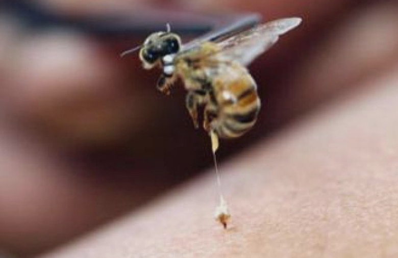 intepatura de albine sau viespi cum eviti socul anafilactic dr stan persoanele cu istoric alergic ar trebui sa aiba intotdeauna la indemana medicatia de urgenta 68ad041f70a12