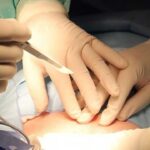 medicii din iasi sunt socati de cazul unei tinere de 22 de ani care a ajuns la a cincea cezariana ultima la mai putin de un an de la nasterea anterioara 6893f45c42da7