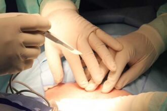 medicii din iasi sunt socati de cazul unei tinere de 22 de ani care a ajuns la a cincea cezariana ultima la mai putin de un an de la nasterea anterioara 6893f45c42da7