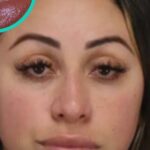 stomatologie practicata ilegal o femeie de 35 de ani a fost arestata dupa ce a instalat fatete dentare false folosind superadeziv in loc de adezivi medicali 68af1effe1778