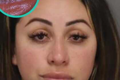 stomatologie practicata ilegal o femeie de 35 de ani a fost arestata dupa ce a instalat fatete dentare false folosind superadeziv in loc de adezivi medicali 68af1effe1778