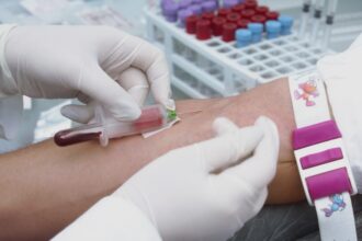 un test de sange poate detecta scleroza laterala amiotrofica cu un deceniu inainte de aparitia simptomelor 68b3fc539422a