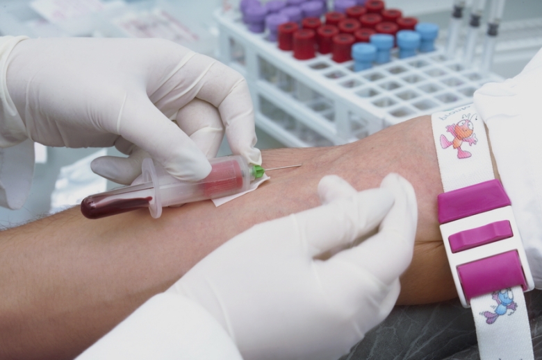 un test de sange poate detecta scleroza laterala amiotrofica cu un deceniu inainte de aparitia simptomelor 68b3fc539422a