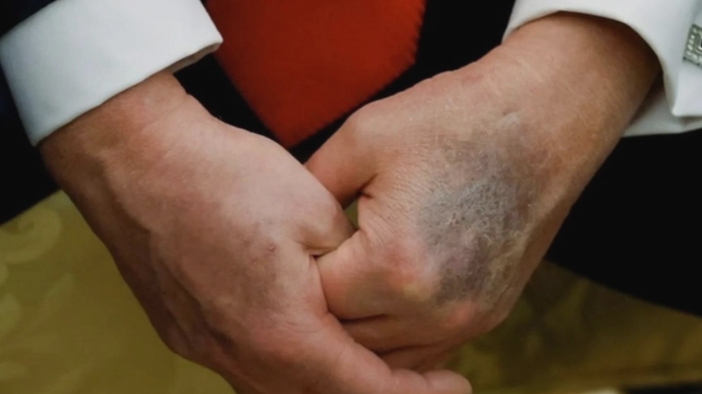 zvonuri despre moartea lui donald trump agita retelele sociale casa alba nu comenteaza iar j d vance face afirmatii stranii 68b34d3b6f79b