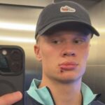 accidentare atipica de fotbalist haaland s a lovit de usa autocarului nationalei norvegiei a avut nevoie de trei copci 68be873290e71