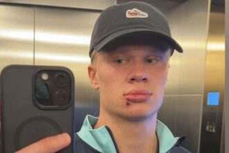 accidentare atipica de fotbalist haaland s a lovit de usa autocarului nationalei norvegiei a avut nevoie de trei copci 68be873290e71