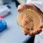 ce este candidozyma auris imuna la multiple medicamente si care se raspandeste in romania 68c2cc85c4854