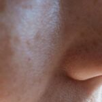 cum sa scapi de punctele negre de pe nas ingredientul din bucatarie care curata tenul 68cc3ca38a6eb