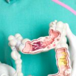 fenomen ingrijorator tot mai multi tineri si copii din iasi sufera de boli inflamatorii intestinale specifice celor mari care e cauza explicatiile gastroenterologului 68ce09a7bb4a5