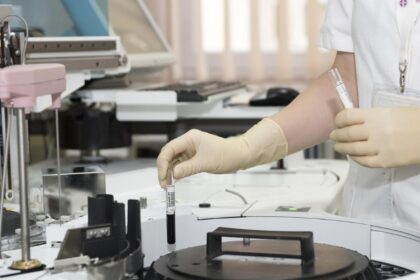 sapte focare de hepatita a confirmate intr un judet din romania aproape 150 de imbolnaviri si sute de persoane monitorizate 68dbc46e71dc5