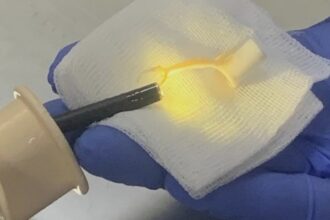 situatie neobisnuita la spitalul de pneumoftiziologie din iasi un pacient s a prezentat la unitatea medicala dupa ce inghitit jumatate de unghiera 68b7869cd2a39