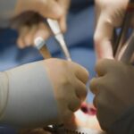 tanar operat de urgenta la iasi dupa ce si a taiat grav antebratul intr un geam 68b53ee1c772f