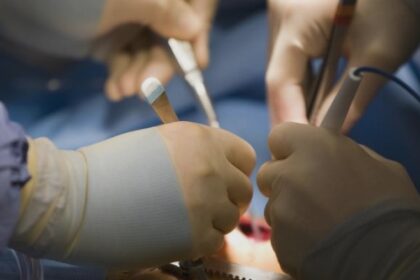 tanar operat de urgenta la iasi dupa ce si a taiat grav antebratul intr un geam 68b53ee1c772f