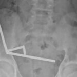 caz socant un baiat de 13 ani operat de urgenta dupa ce a inghitit aproape 200 de magneti 68fd02af4f714