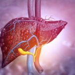 modificari minore in alimentatie ar putea preveni o boala comuna a ficatului 68f4ad003c4ad