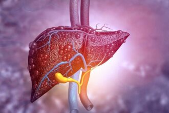 modificari minore in alimentatie ar putea preveni o boala comuna a ficatului 68f4ad003c4ad