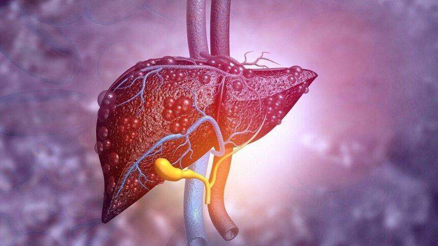 modificari minore in alimentatie ar putea preveni o boala comuna a ficatului 68f4ad003c4ad