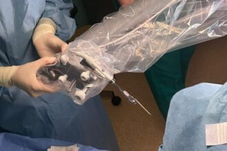 prima implantare cohleara asistata robotic in romania realizata la iasi 69032d74d2e0f