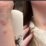 conditii jalnice in trenul bucuresti sighet o tanara a ajuns la spital dupa ce a fost muscata de plosnite intr un vagon cuseta 69232a9a7758b