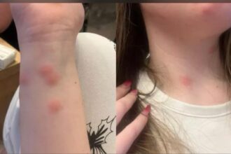 conditii jalnice in trenul bucuresti sighet o tanara a ajuns la spital dupa ce a fost muscata de plosnite intr un vagon cuseta 69232a9a7758b