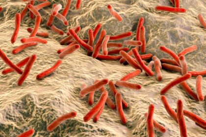 autoritatile din cluj spun ca au sub control situatia cazurilor de lepra nu exista un risc major pentru populatie 69413a67ecfed