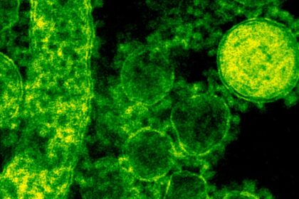 cat de contagioasa este lepra ce spun specialistii 6940053c35aa2