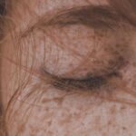 caz iesit din comun intr un spital din romania medicii au extras un vierme de 11 centimetri din pleoapa unei tinere 692d9bc07d5d0